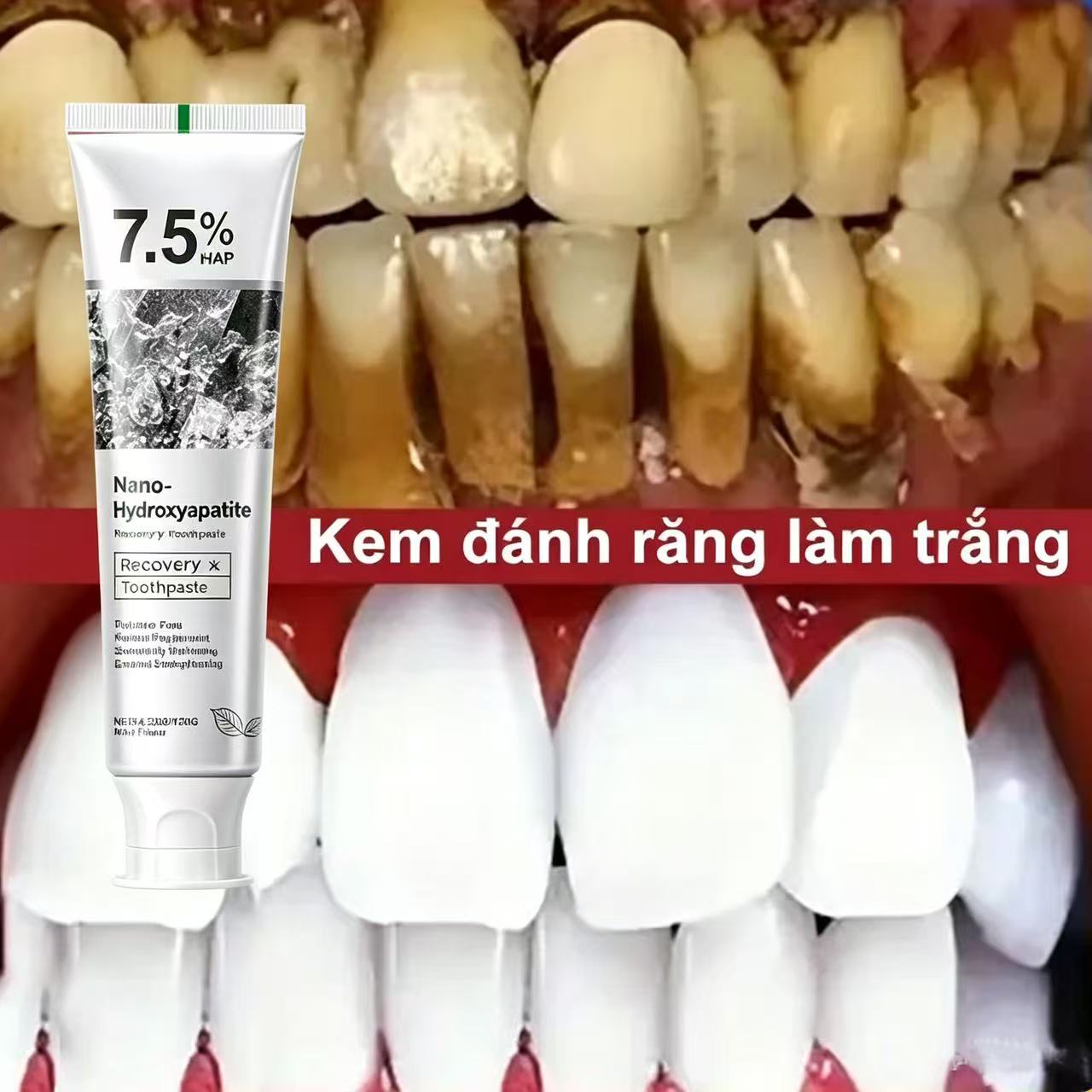Teeth Whitening Best - 7.5% Hydroxyapatite Probiotic Whitening Toothpaste Enamel