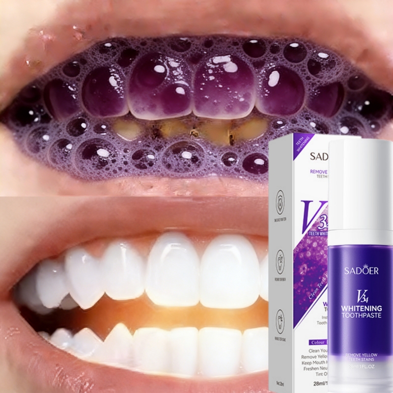 2026 Bestselling Whitening Too - đánh giá và giá Teeth Whitening Effective