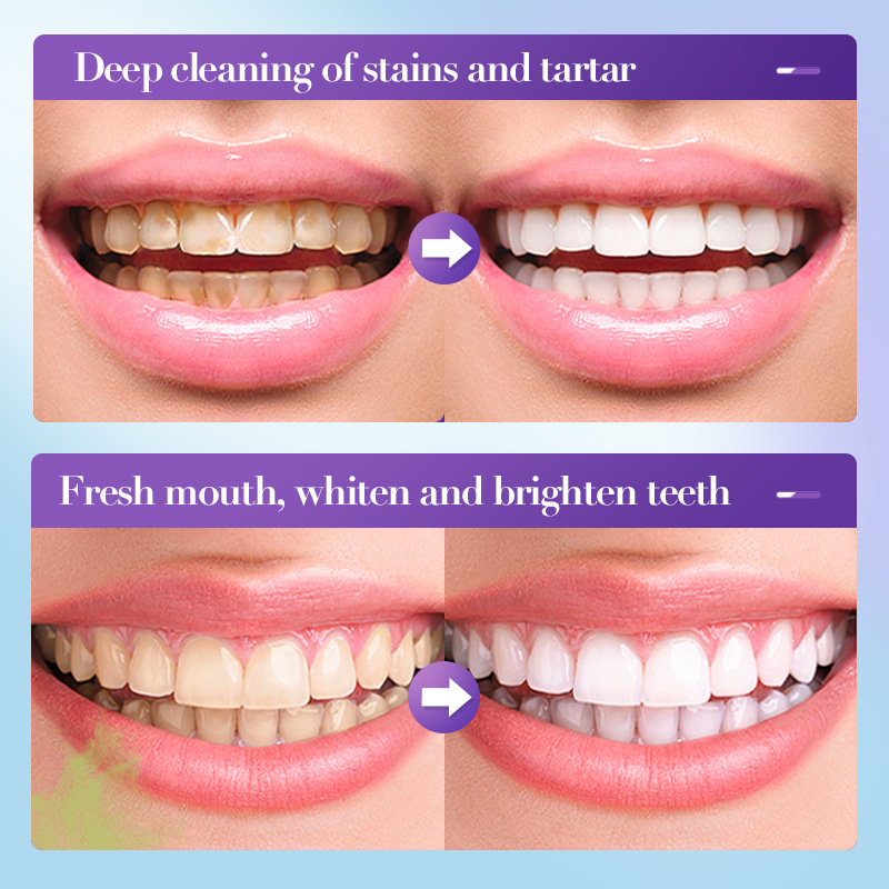 2026 Bestselling Whitening Too - đánh giá và giá Teeth Whitening Effective