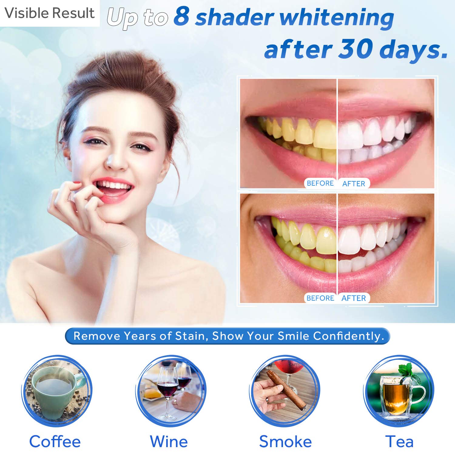 Teeth Whitening Gel Refill Syr - đánh giá và giá Teeth Whitening Ulta