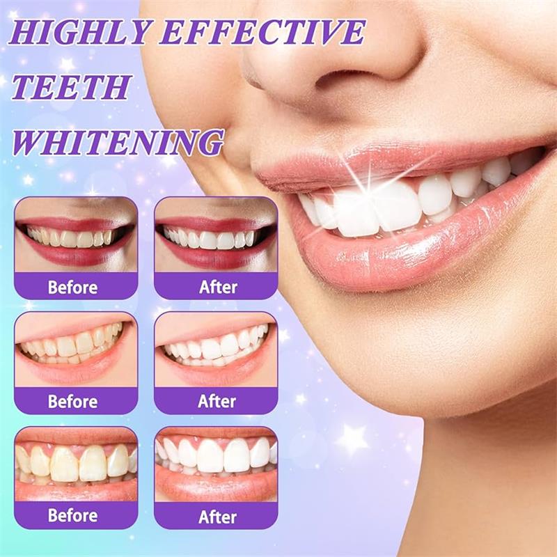 9D Purple Teeth Whitening Toot - đánh giá và giá Teeth Whitening Best