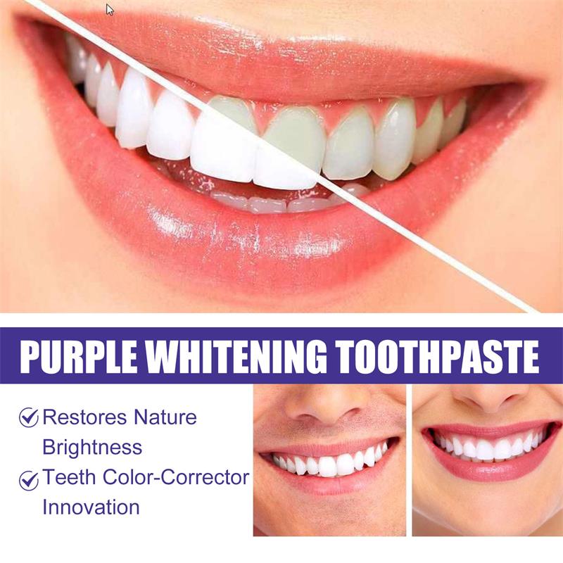 9D Purple Teeth Whitening Toot - đánh giá và giá Teeth Whitening Best