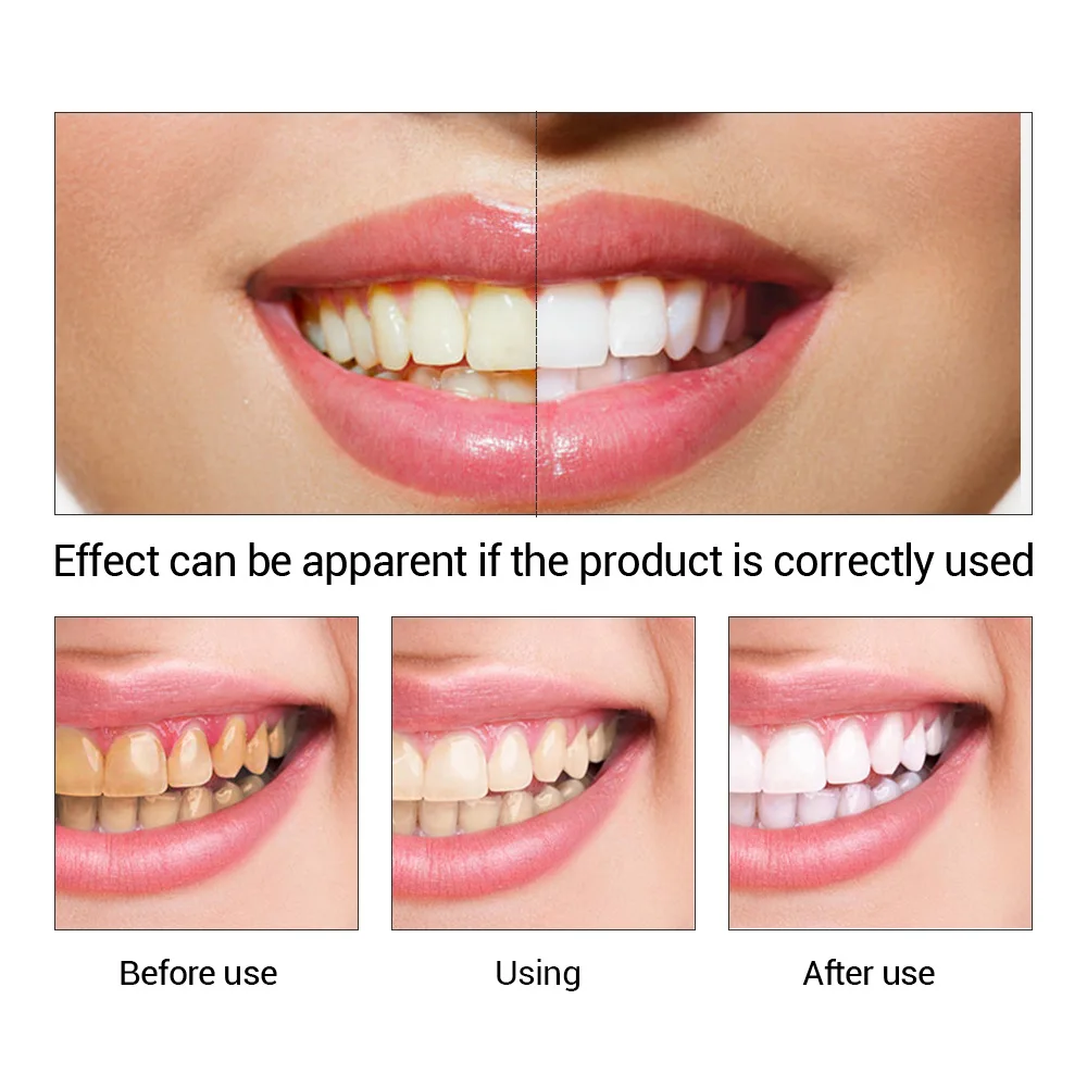 FTEENPLY Làm Trắng Răng Tinh C - đánh giá và giá Teeth Whitening Ulta