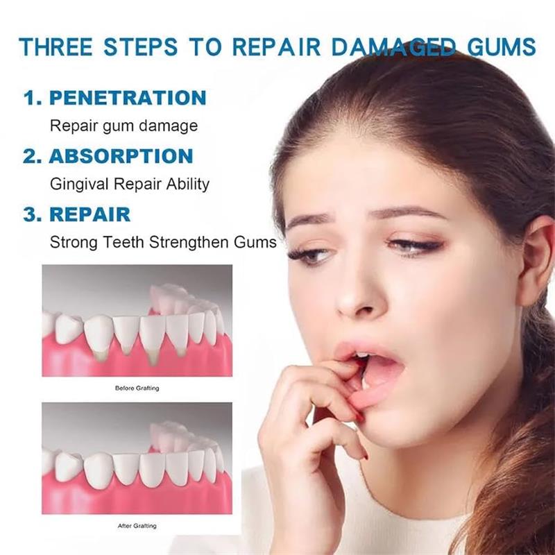 Gum Repair Care Serum Relieve  - đánh giá và giá Teeth Whitening Gingival Barrier