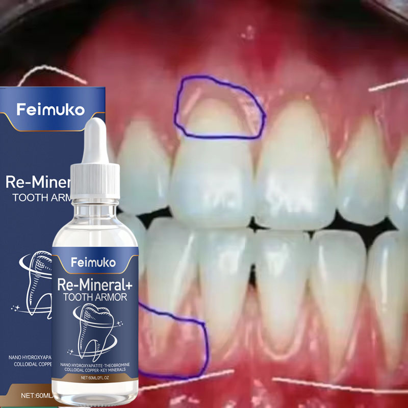 Gum Repair Care Serum Relieve  - đánh giá và giá Teeth Whitening Gingival Barrier