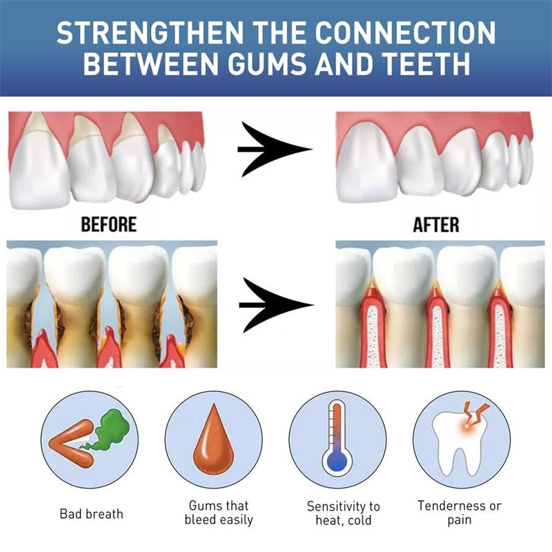 Gum Repair Care Serum Relieve  - đánh giá và giá Teeth Whitening Gingival Barrier