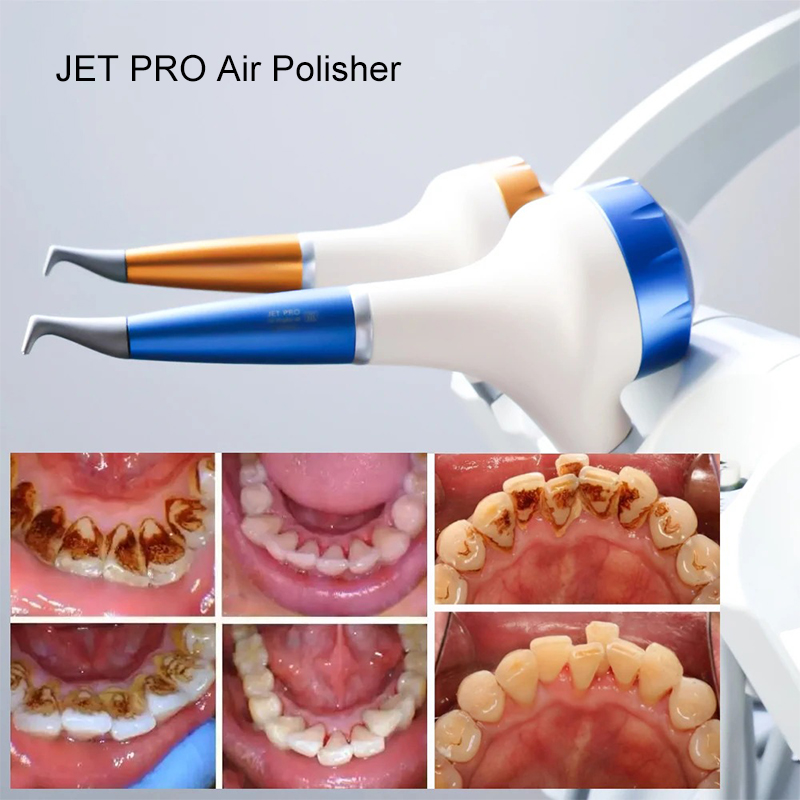 VV Dental  Air Polishing Proph - đánh giá và giá Teeth Whitening Dental