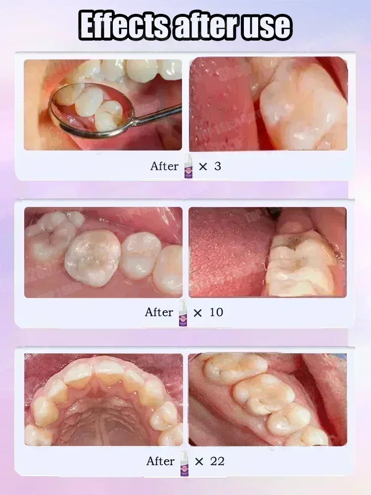 Hot sales Best-selling, Scient - đánh giá và giá Teeth Whitening Best