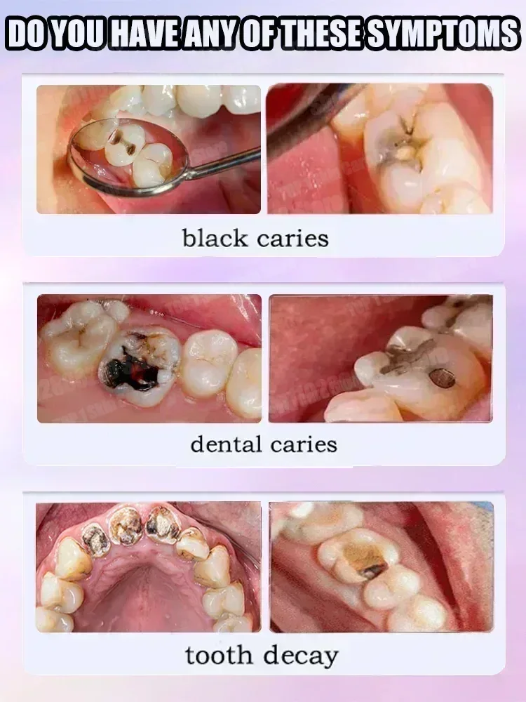 Hot sales Best-selling, Scient - đánh giá và giá Teeth Whitening Best