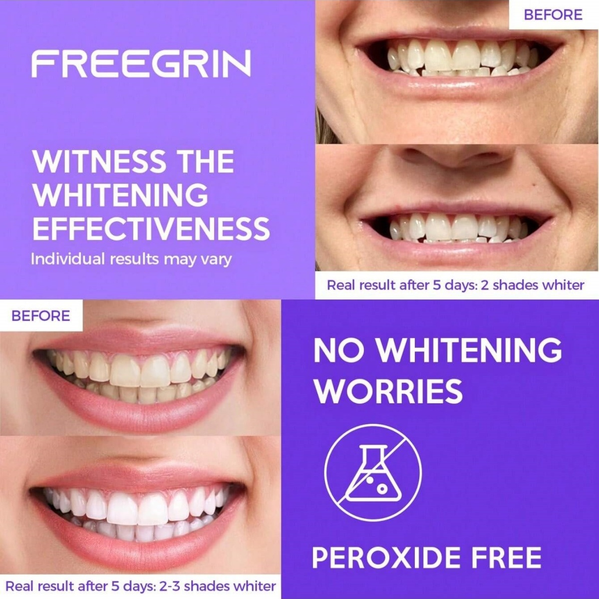 Deluxe Whitening Teeth Sticker - đánh giá và giá Teeth Whitening Foam